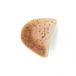 Shell Tapas Bowl - Speckeled